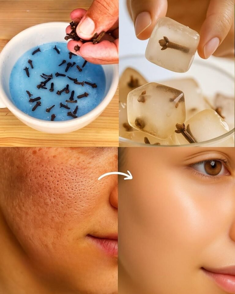 ❄️🌿 Why “Clove Ice” Has Become One of the Most Talked-About Secrets for Porcelain-Smooth Skin