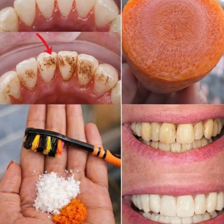 Teeth Whitening at Home: What Works, What Doesn’t, and How to Protect Your Smile