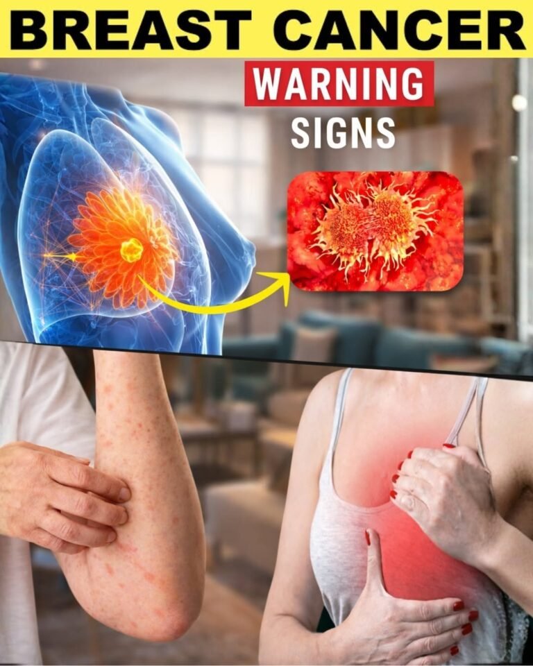 10 Warning Signs of Breast Cancer You Should Never Ignore
