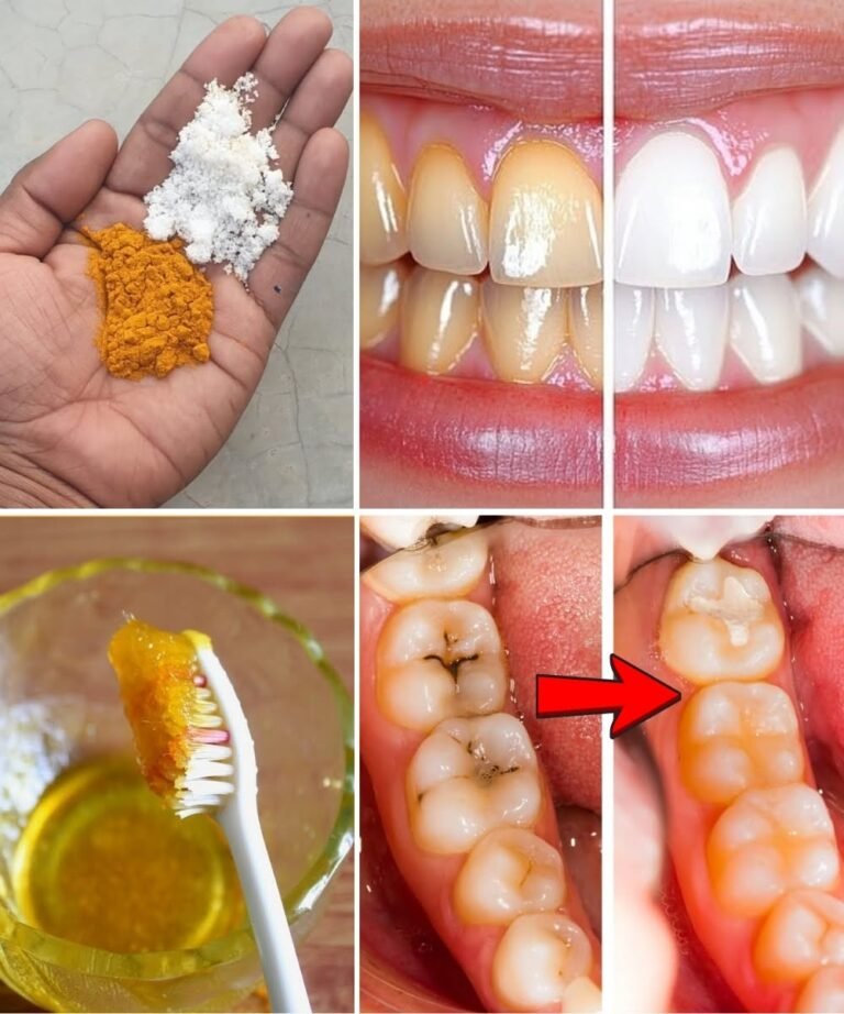 Turmeric for Teeth Whitening: Can This Natural Remedy Really Brighten Your Smile?