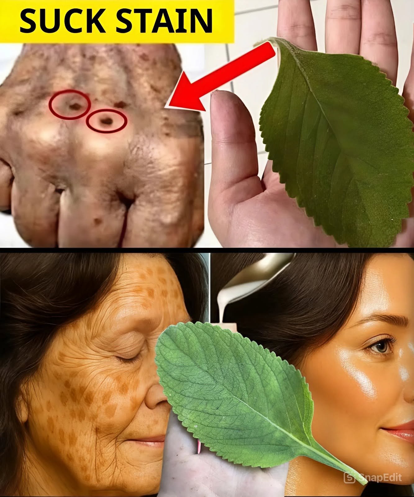 Old Wrinkles and Drooping Mouth? Not Anymore
