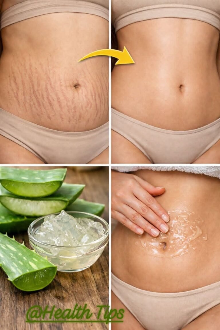 Natural Ways to Care for Stretch Marks: 4 Gentle Options