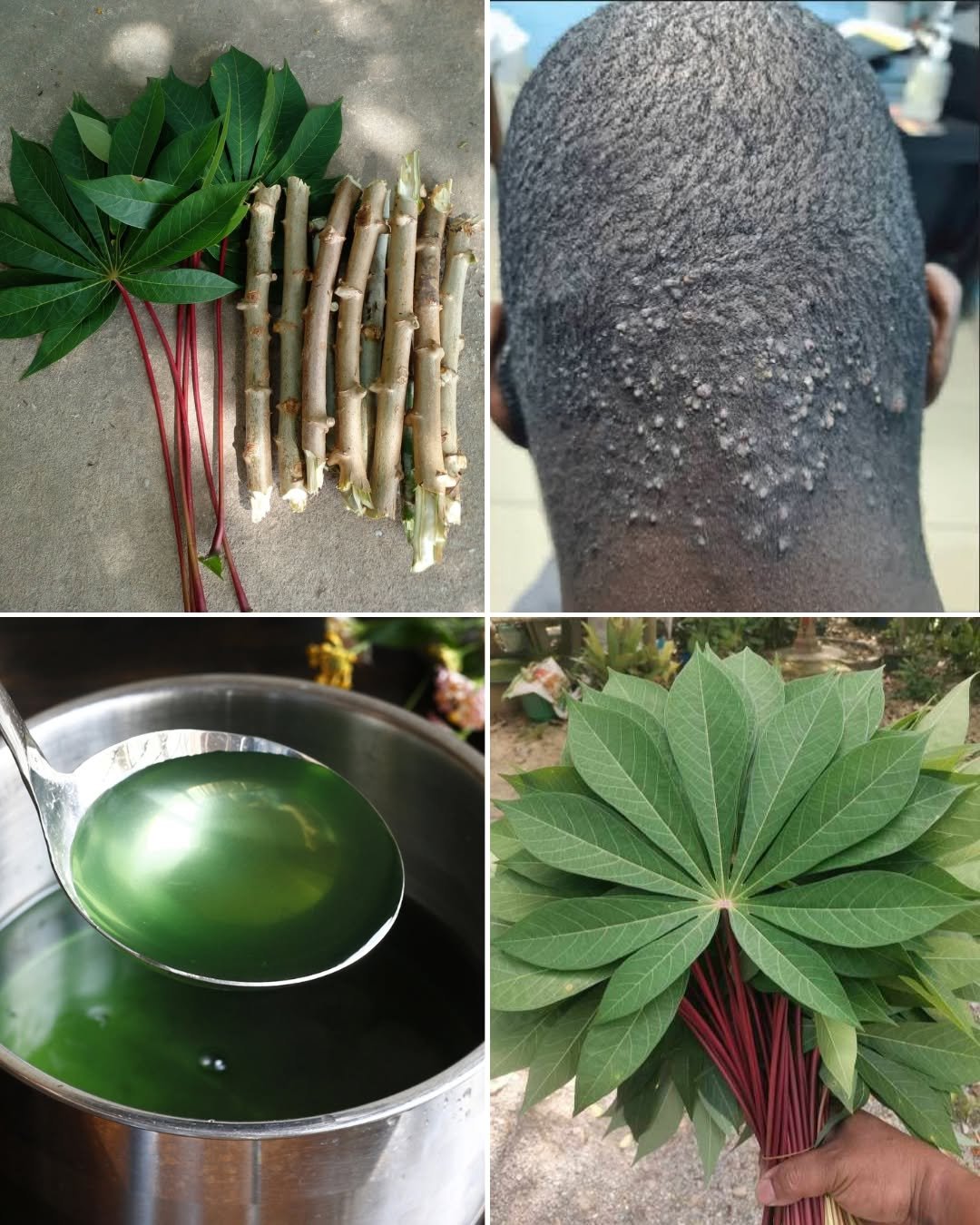 Natural Remedy for Back Head Bumps: Bitter Leaves & Cassava Leaves Treatment