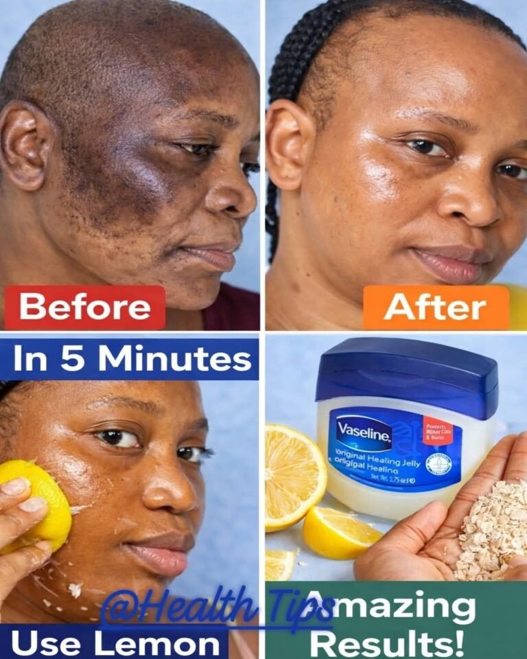 🍋 Lemon on Your Face? Try This Safer Skincare Approach Instead ✨