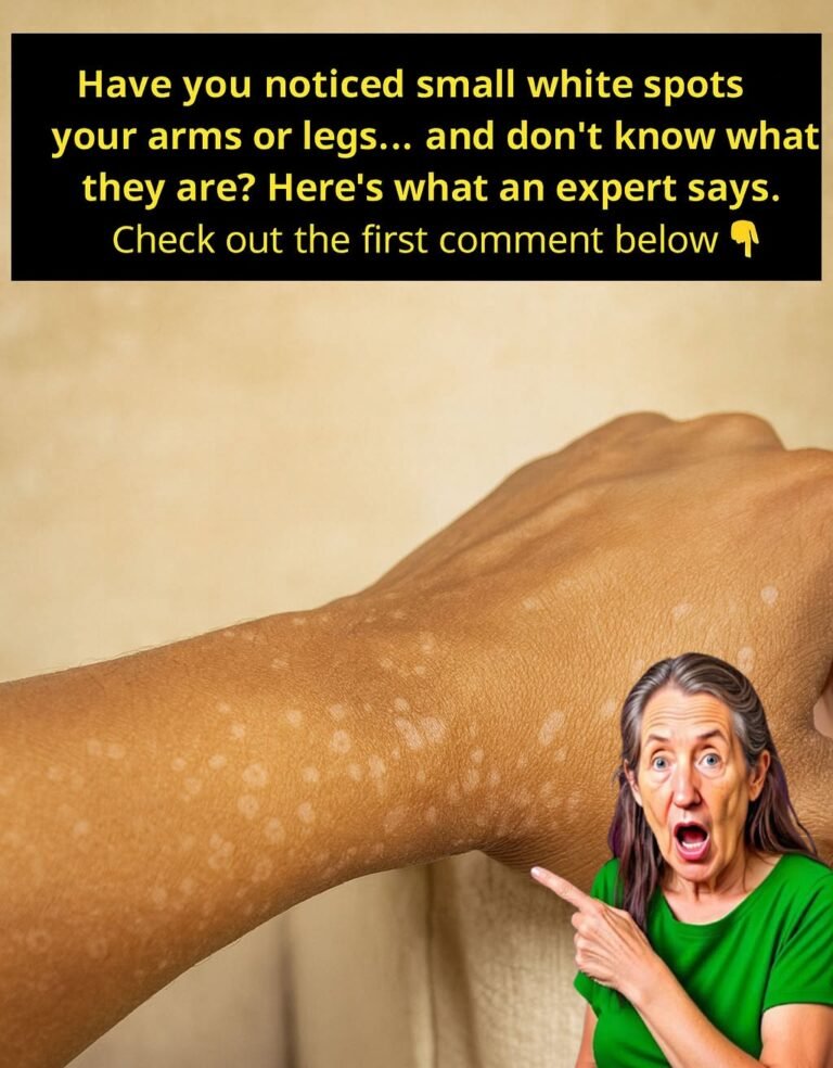 Why Do White Spots Appear on Your Skin?