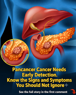 Pancreatic Cancer Warning Signs You Should Never Ignore: Symptoms That Deserve Medical Attention