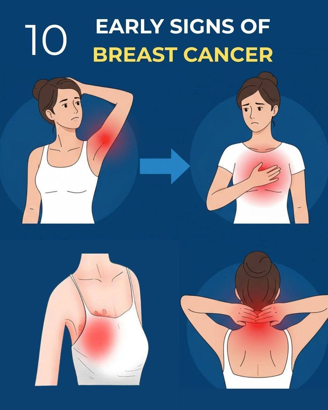 Your Body May Be Sending Signals: 10 Potential Symptoms of Breast Cancer You Shouldn't Ignore