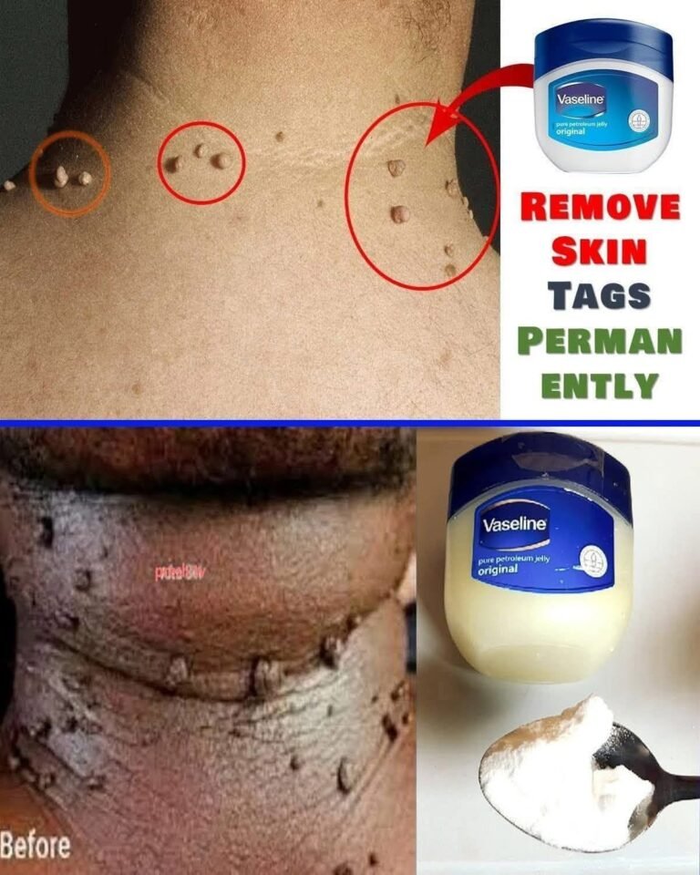 Plantar Warts and Skin Tags: What Helps, What Doesn’t, and Safe Skin Care Tips