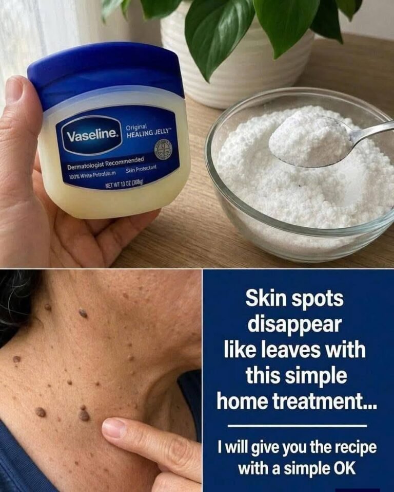 How to Remove Warts Naturally: Home Remedies and Gentle Skin Care Tips