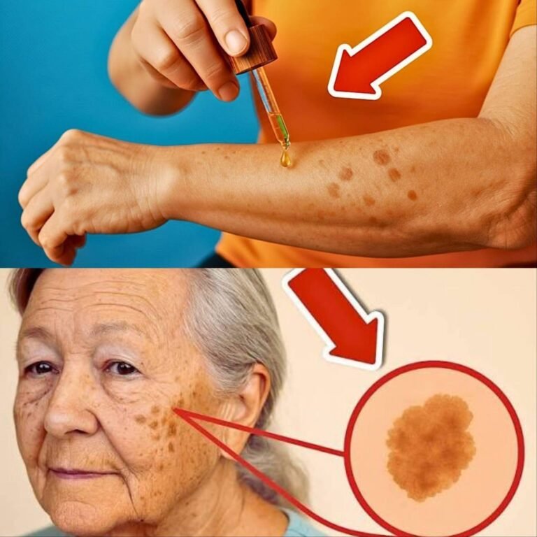 Age spots disappear FOREVER when you rub THIS on your skin 💥 (Incredibly fast) 🤯