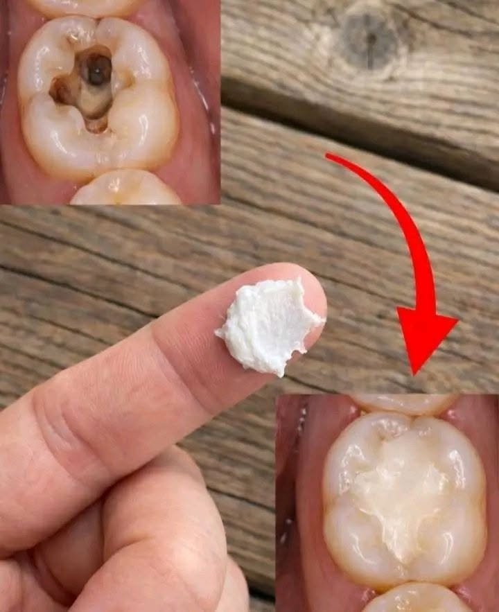 How to Naturally Whiten Your Teeth at Home in Just 3 Minutes