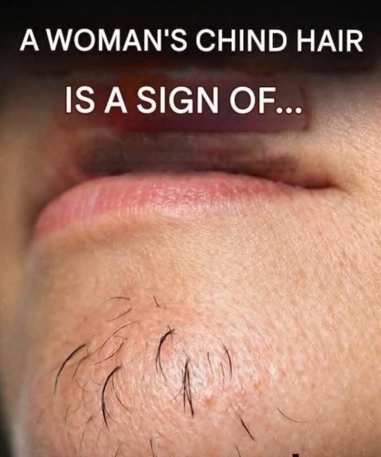 Surprising Truth About Chin Whiskers in Women