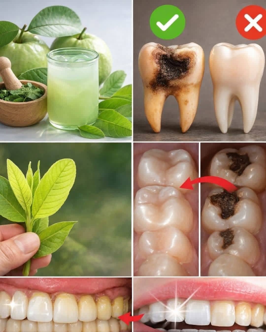 3 Ways to Use Guava Leaves for Oral Health and Toothache Relief