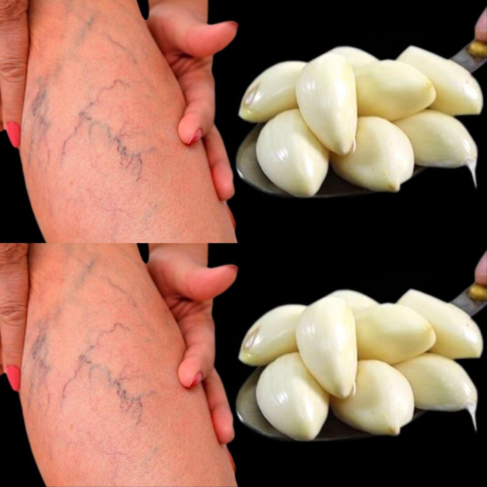 Leg pain, rheumatism, varicose veins, arthritis, headache, joint pain.