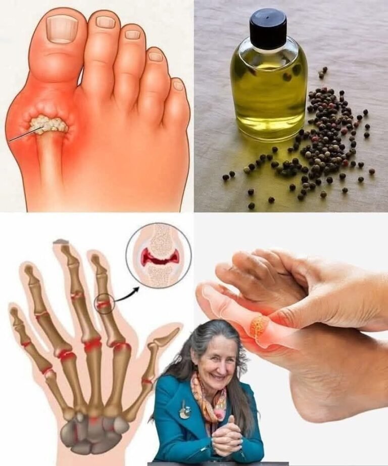 The oil renowned for eliminating uric acid from the bloodstream, alleviating anxiety, chronic arthritis, rheumatism, and reducing cravings for cigarettes and alcohol.