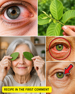 How Guava Can Support Eye Health Naturally: Benefits, Safe Uses, and What Science Says