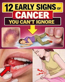 12 Early Warning Signs of Cancer You Should Never Ignore