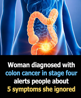 5 Colon Cancer Symptoms You Should Never Ignore: Warning Signs That Deserve Attention