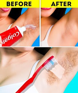 The Easiest Way to Remove Facial and Body Hair Without Pain – Using Onion + Toothpaste at Home (100% Natural Ingredients)