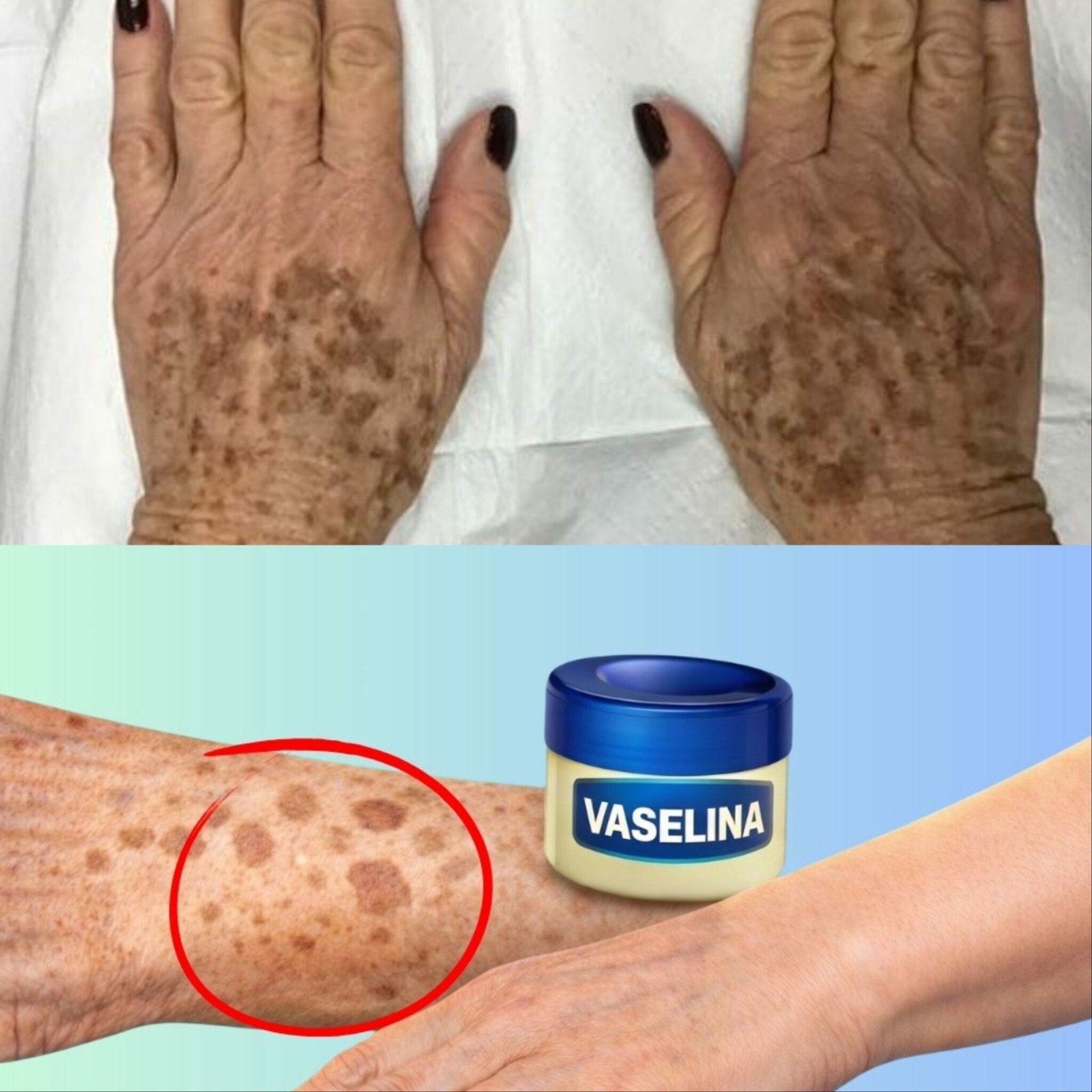 Brown Spots on Your Hands After 60? Here's What You Should Know