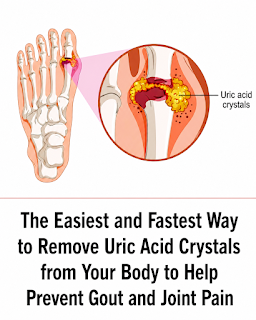 Natural Ways to Help Relieve Gout and Joint Discomfort: Lifestyle Tips That Support Long-Term Joint Health