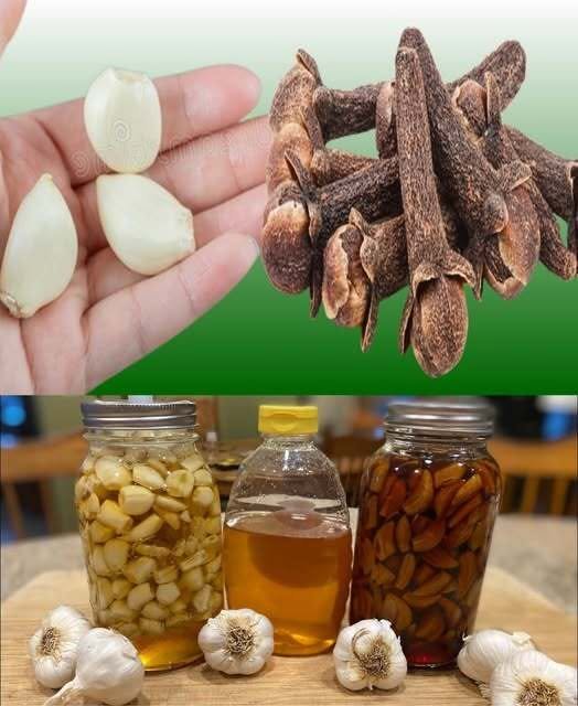 Unlocking the Power of Garlic, Cloves, and Honey: Your Natural Health Solution