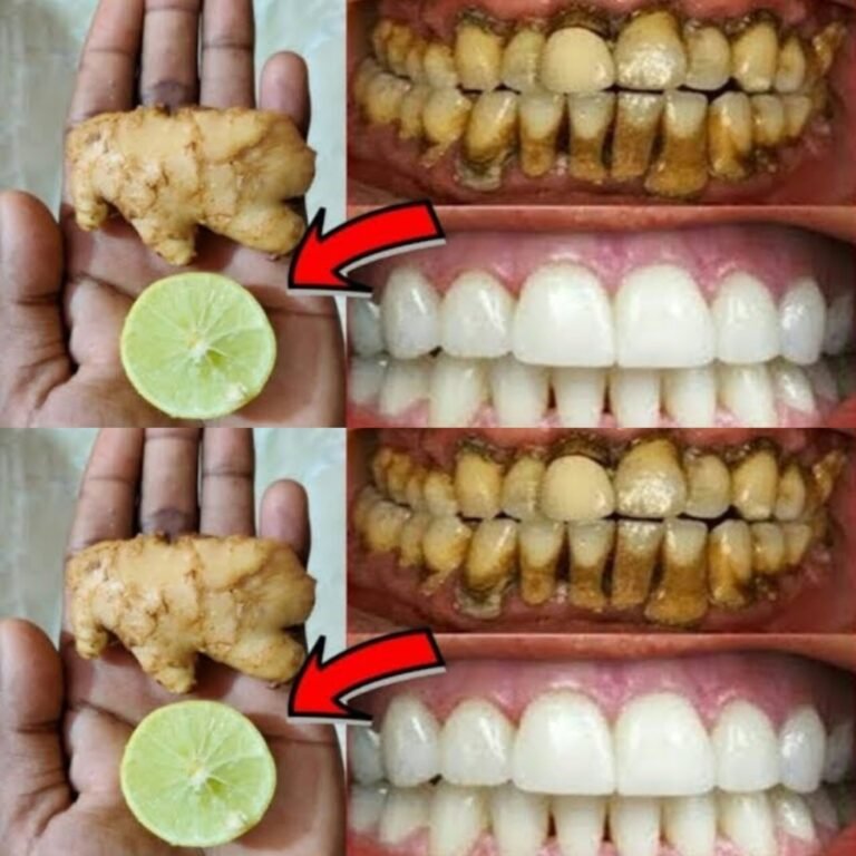 In Just 2 Minutes, This Recipe Will Turn Yellow Teeth White Like Pearls!