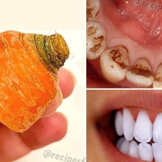 Turn Yellowing and Tartar Buildup into Shiny Milky White with Carrot Tops!