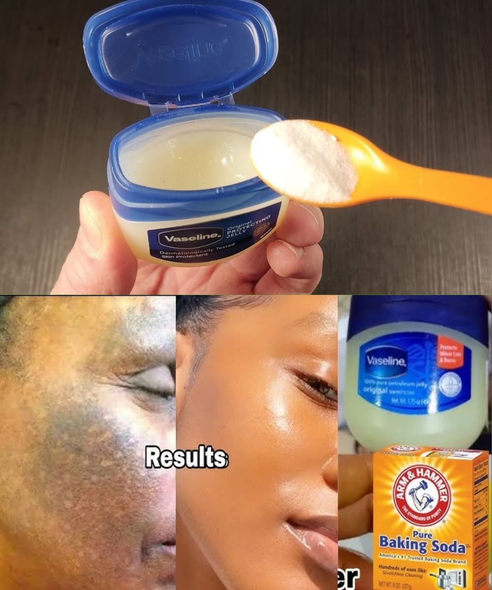 Combine Baking Soda with Vaseline: A Quick and Effective Solution! ✨