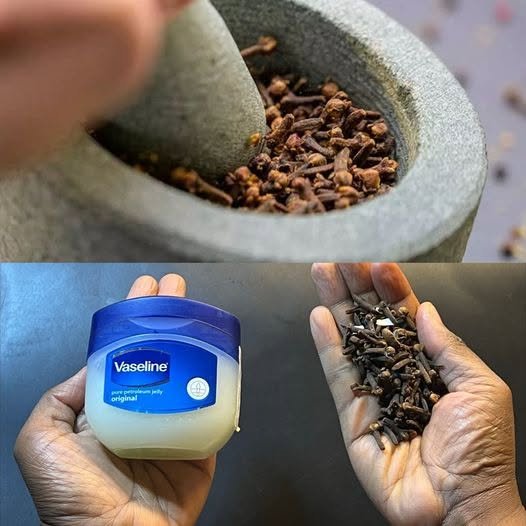 Discover the Power of Cloves and Vaseline