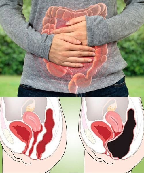 How to Cleanse Your Colon Naturally at Home (Colon Cleanse Smoothie)