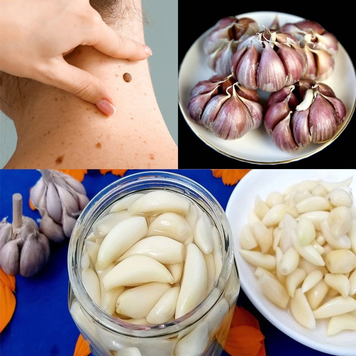 Permanent solution to skin tag