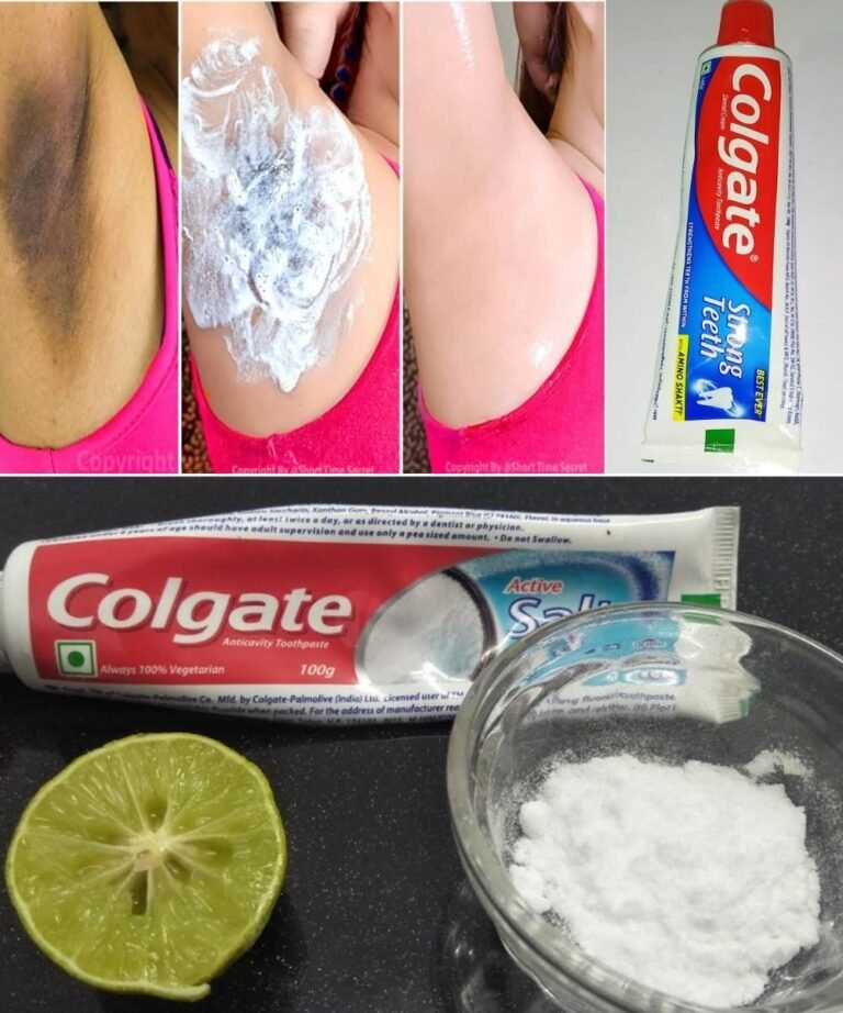 Brighten Dark Underarms Naturally with Toothpaste – Yes, Really! 🌟