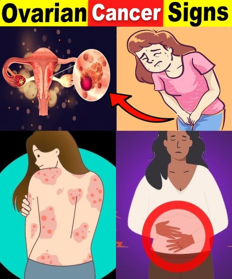 9 Common Ovarian Cancer Signs That You Should Never Ignore