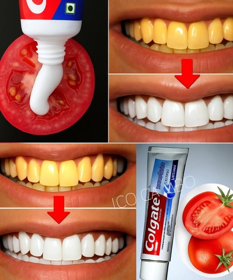 Say Goodbye to Yellow Teeth with This Simple Kitchen Recipe 🦷✨