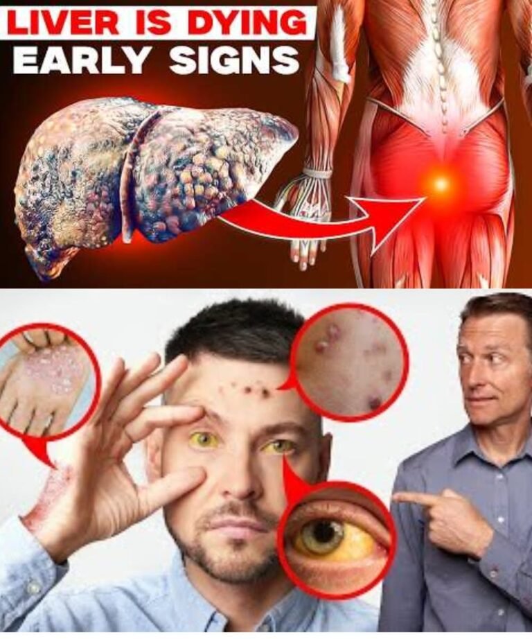 🌿 17 Subtle Signs Your Liver May Need More Care — And Gentle Ways to Support It