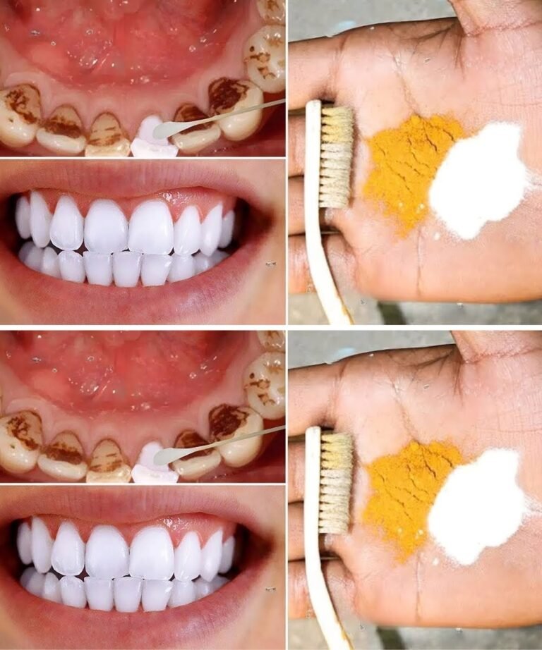 Home Teeth Whitening: Get Whiter Teeth in Just 2 Minutes!
