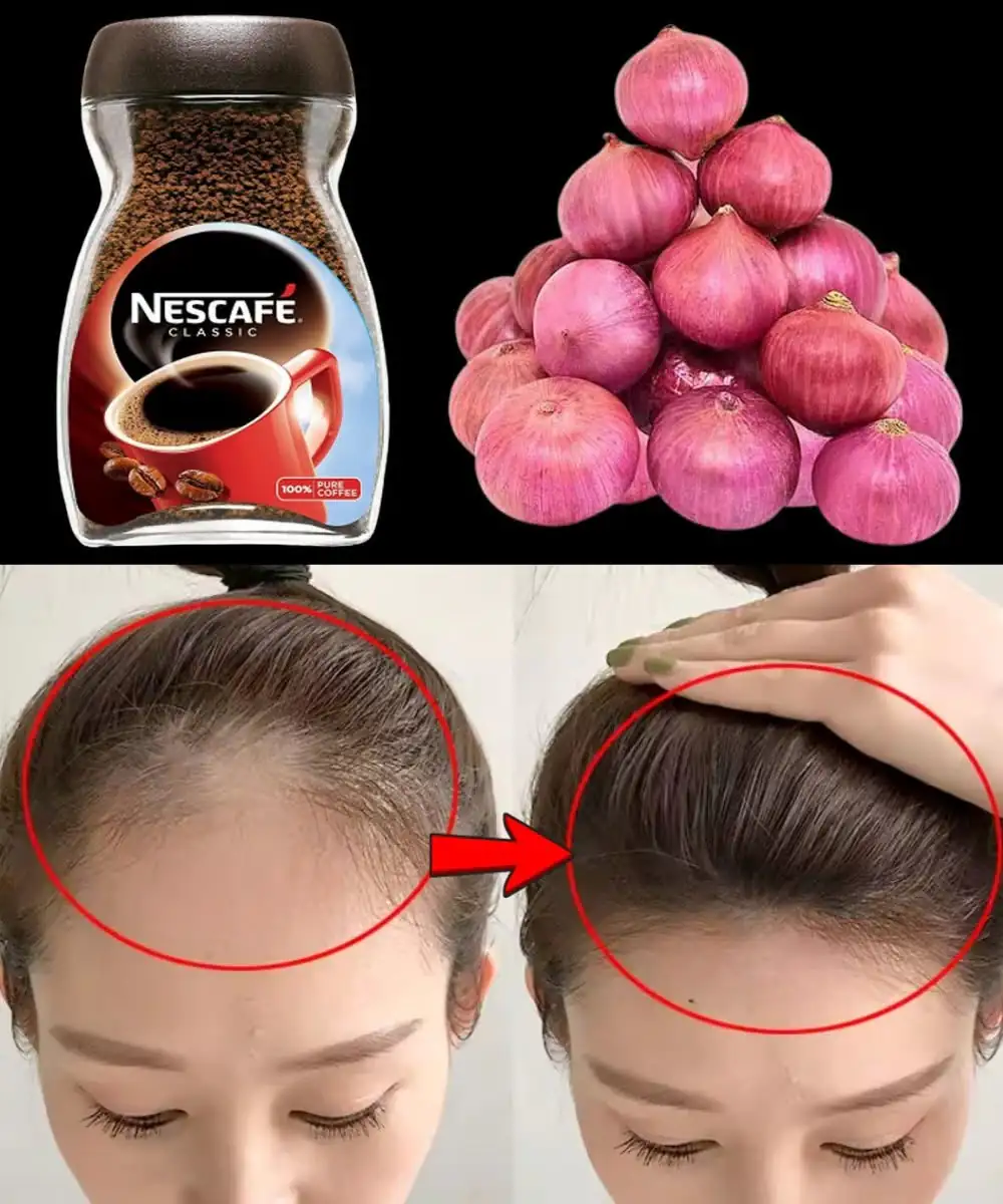 Stop Hair Fall Naturally: The Coffee, Garlic & Onion Hair Growth Remedy