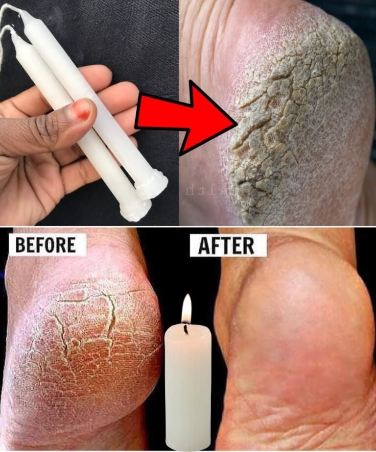 Soften, Heal, and Restore Your Feet Overnight with Candle Wax