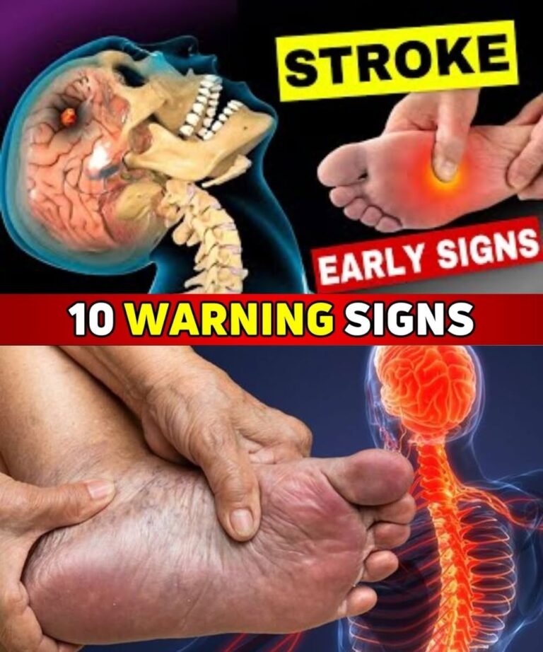 10 Surprising Signs a Stroke Might Be Coming – Weeks Before It Happens 🧠💡