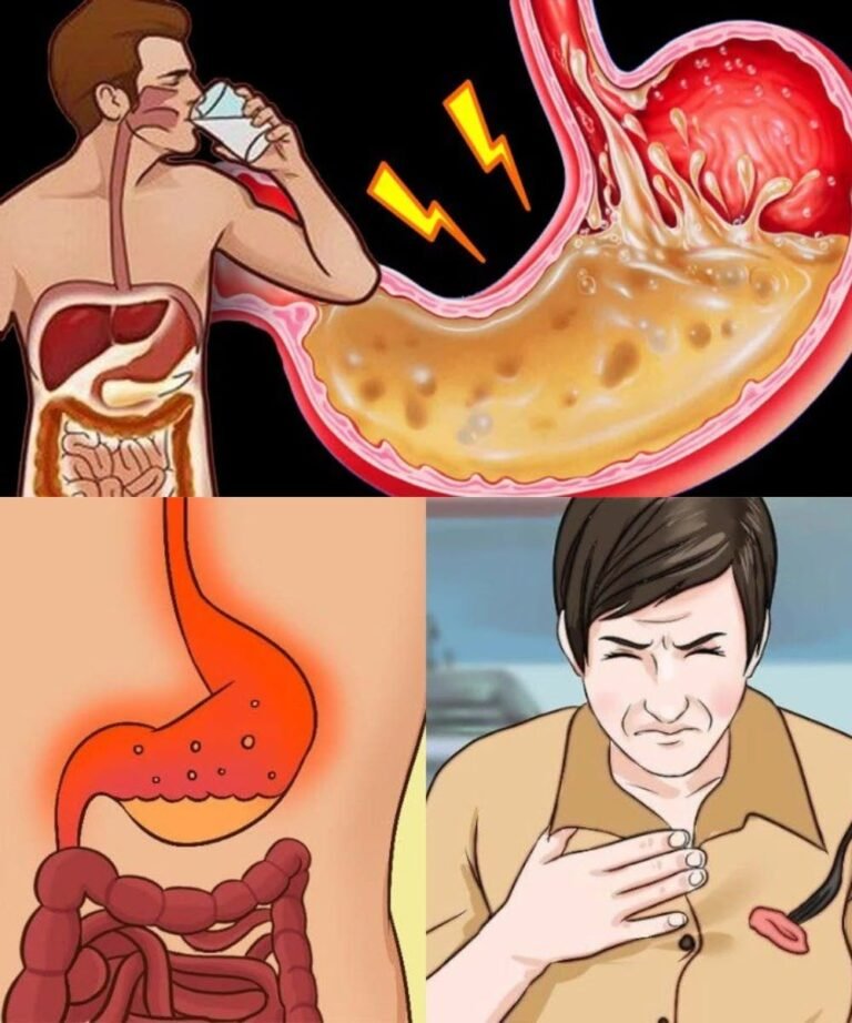 Eating Habits That Make Your Stomach and Intestines Cry for Help