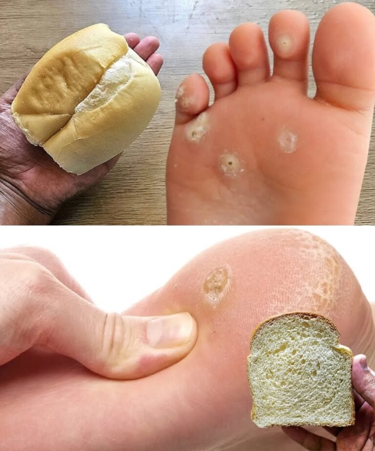 Remove Foot Calluses Naturally with This Surprising Bread Remedy
