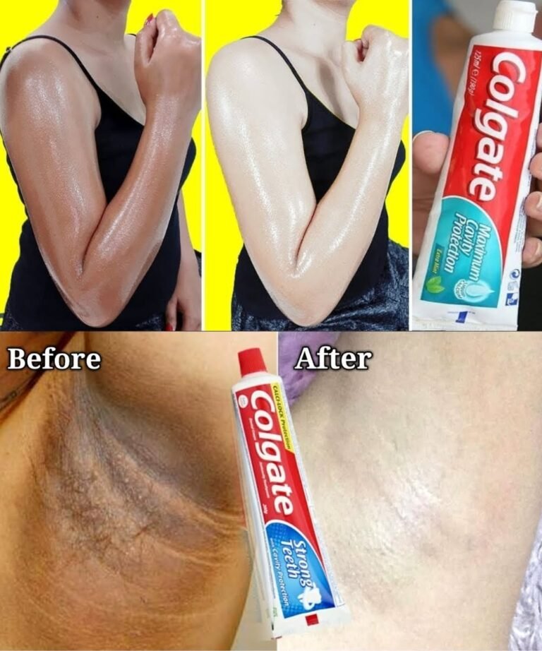 3 Skin Whitening Home Remedies | Natural Skin Whitening Treatment in Just 3 Minutes