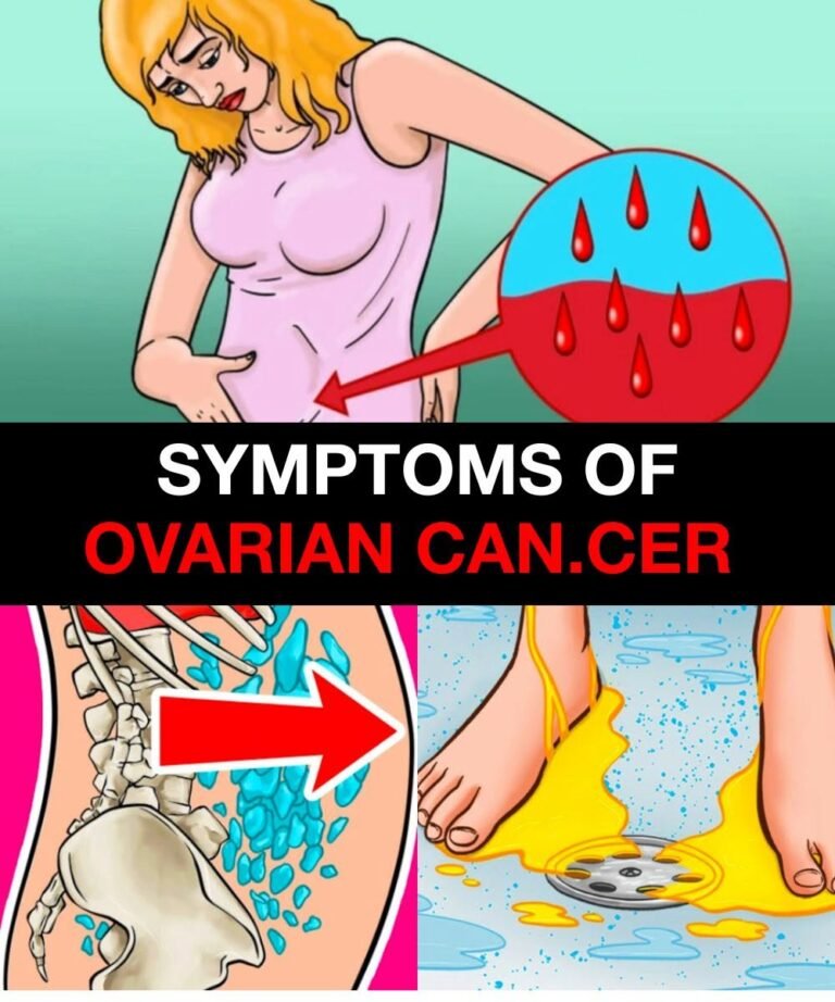 The link between ovarian and breast cancer!!