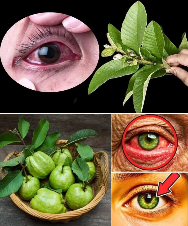 Guava Leaves for Red Eyes: A Natural Remedy That Really Works