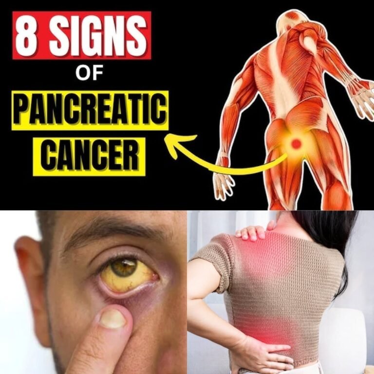⚠️ 8 Shocking Symptoms of Pancreatic Cancer You Should NEVER Ignore | Early Warning Signs