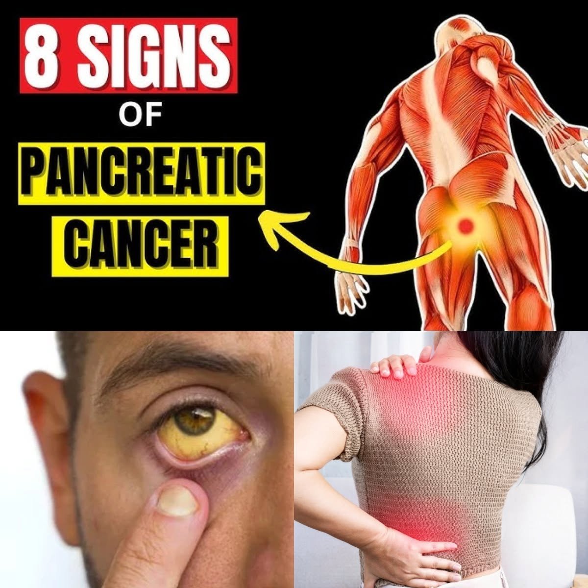 ⚠️ 8 Shocking Symptoms of Pancreatic Cancer You Should NEVER Ignore | Early Warning Signs