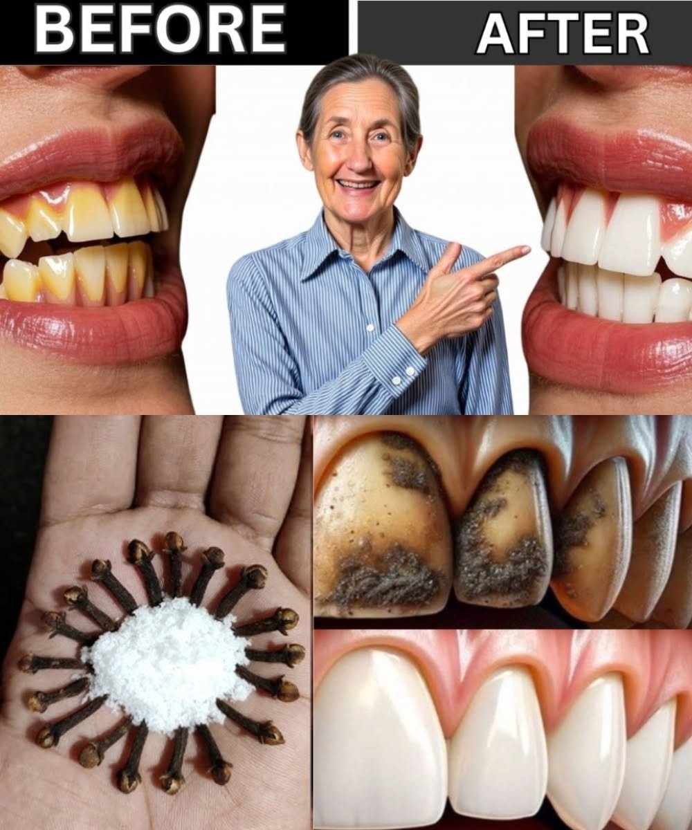 Chewing Cloves Daily: The Natural Secret to Stronger Teeth and Fresher Breath