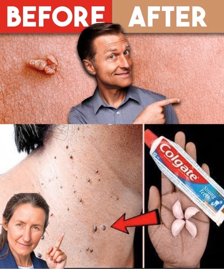 Say Goodbye to Warts and Skin Tags—Naturally