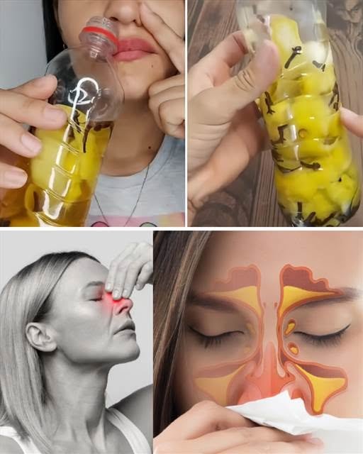 Natural Remedy for Rhinitis, Sinusitis, and Labyrinthitis